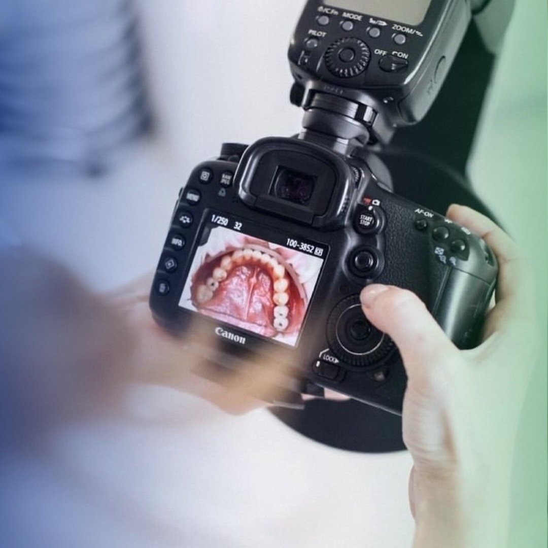 DigiScan